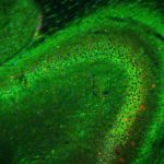 Hippocampus by confocal microscopy, Eva Rodrigues