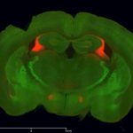 Double fluorescent staining on brain slice, Marylin Lepleux