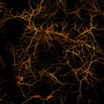 Mosaic of MAP2 neurons, Sébastien Marais