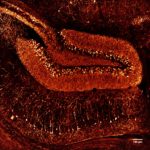 Confocal imaging of mouse hippocampus,Patrice Mascalchi & julie Angibaud