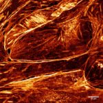 STED imaging of actin network in liver endothelial cells, Patrice Mascalchi & Frédéric Saltel